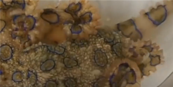 剧毒蓝环章鱼与普通章鱼如何分辨？专家：肉眼就能看出