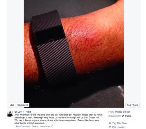 毛病依然存在,Fitbit新款手环仍有用户过敏(图3) Fitbit Charge手环依然会导致皮肤过敏
