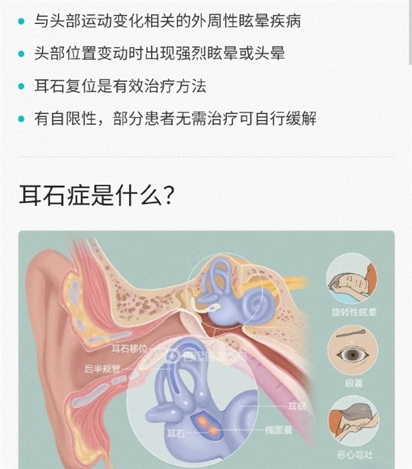 女孩患怪病 看到床就害怕：耳石症 和过度防晒有关