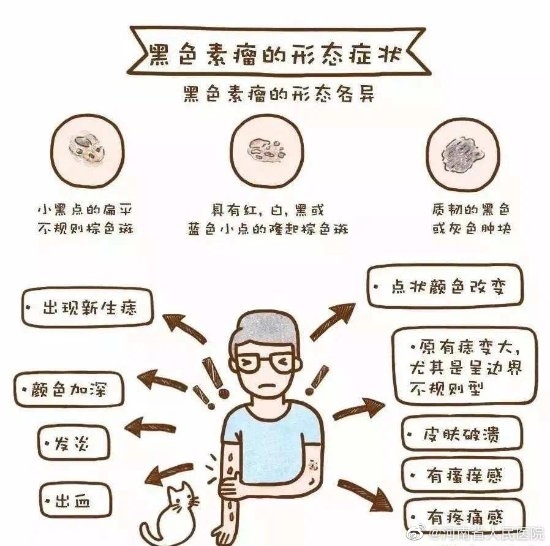 痣也会癌变！37岁男歌手就因此去世：要警惕