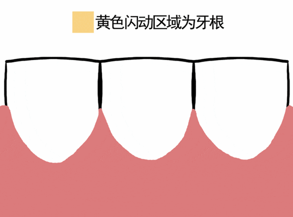 别拿塞牙不当回事！