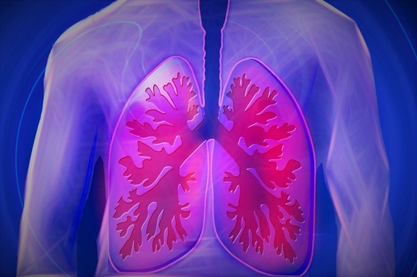 世卫组织：肺癌成为全球新增病例数最多癌症