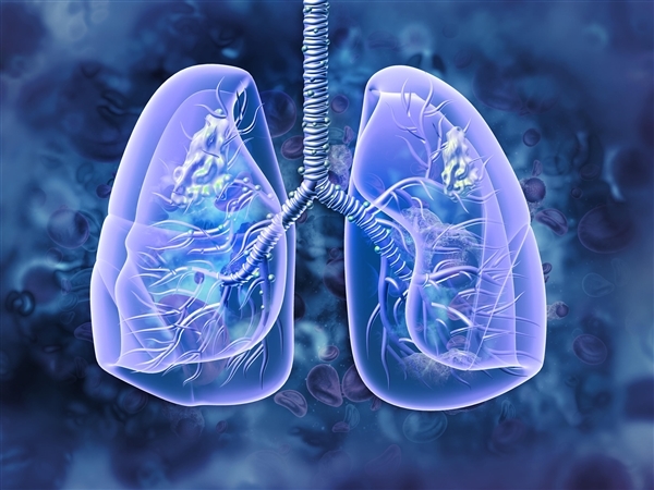 世卫组织：肺癌成为全球新增病例数最多癌症
