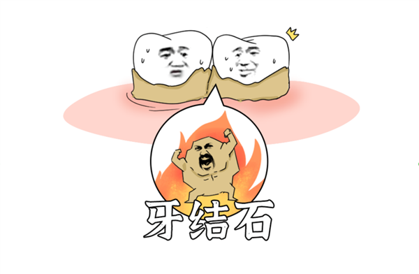 重口味科普！嘴里咳出来贼臭的黄色小颗粒：到底是啥？