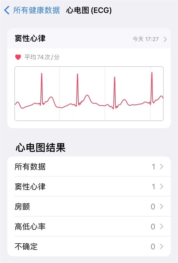 Apple Watch Ultra一周上手：不适合普通用户