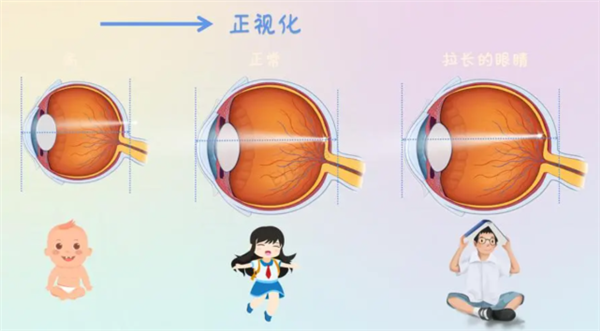 7亿中国人近视!到底是基因的突变?还是环境的变化?
