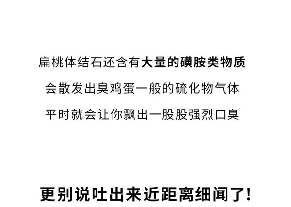 重口味科普！嘴里咳出来贼臭的黄色小颗粒：到底是啥？