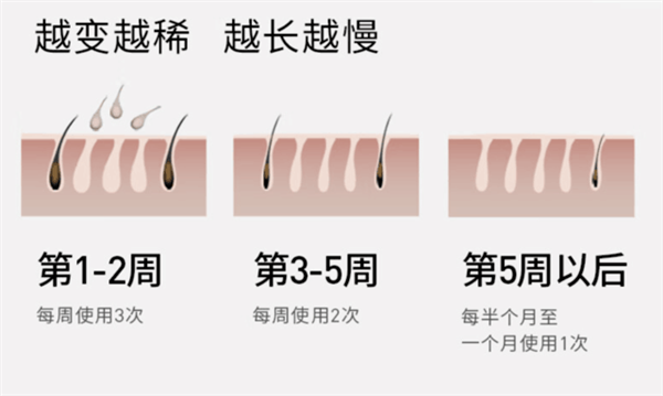 当猛男遇上脱毛仪:用前抗拒、用后真香