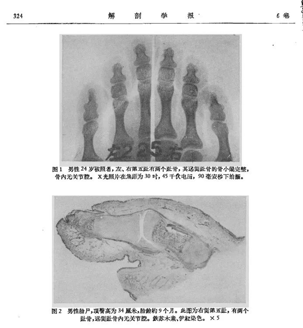 人体共有206块骨头 为啥中国人却普遍只有204块