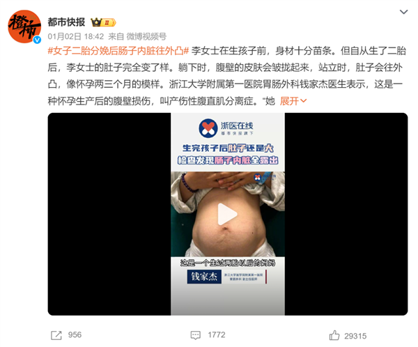 冲上热搜！女子生完二胎肠子内脏往外凸
