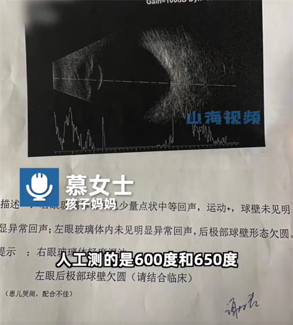 父母高度近视 1岁婴儿近视600度:快速恶化 最快可能失明