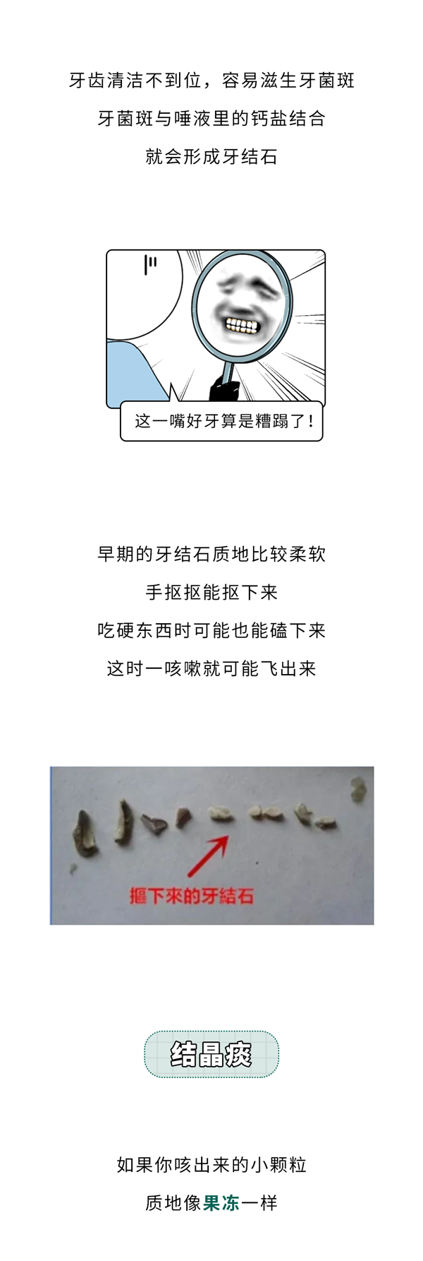重口味科普！嘴里咳出来贼臭的黄色小颗粒：到底是啥？