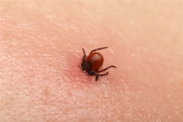 短短50年 超1亿人感染:莱姆病真的是美国生化武器泄漏?