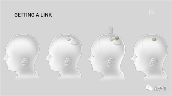 马斯克最新芯片：脑机专用 让失明人群“看见”