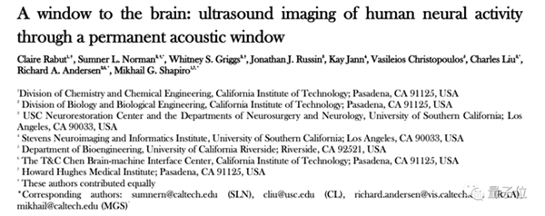 比马斯克脑机接口更精确微创 超声波读脑大法来了