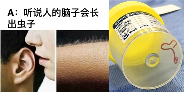 世界首例！人脑中发现长达8厘米的蛔虫：和吃有关