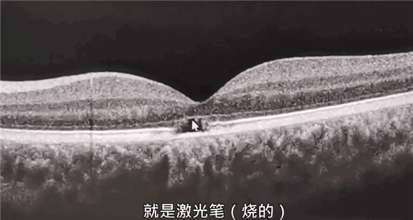 女司机疑开远灯被前车用激光灯射眼:还是驾校教练车