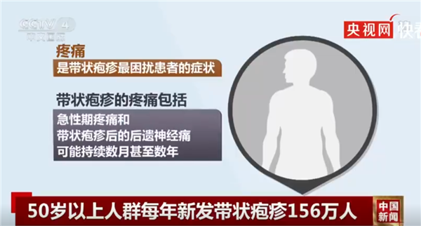 医生:近期带状疱疹病例明显增加 打疫苗可预防