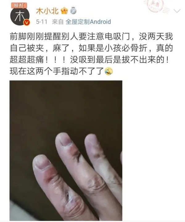 电吸门夹手到底会不会骨折?测试结果来了