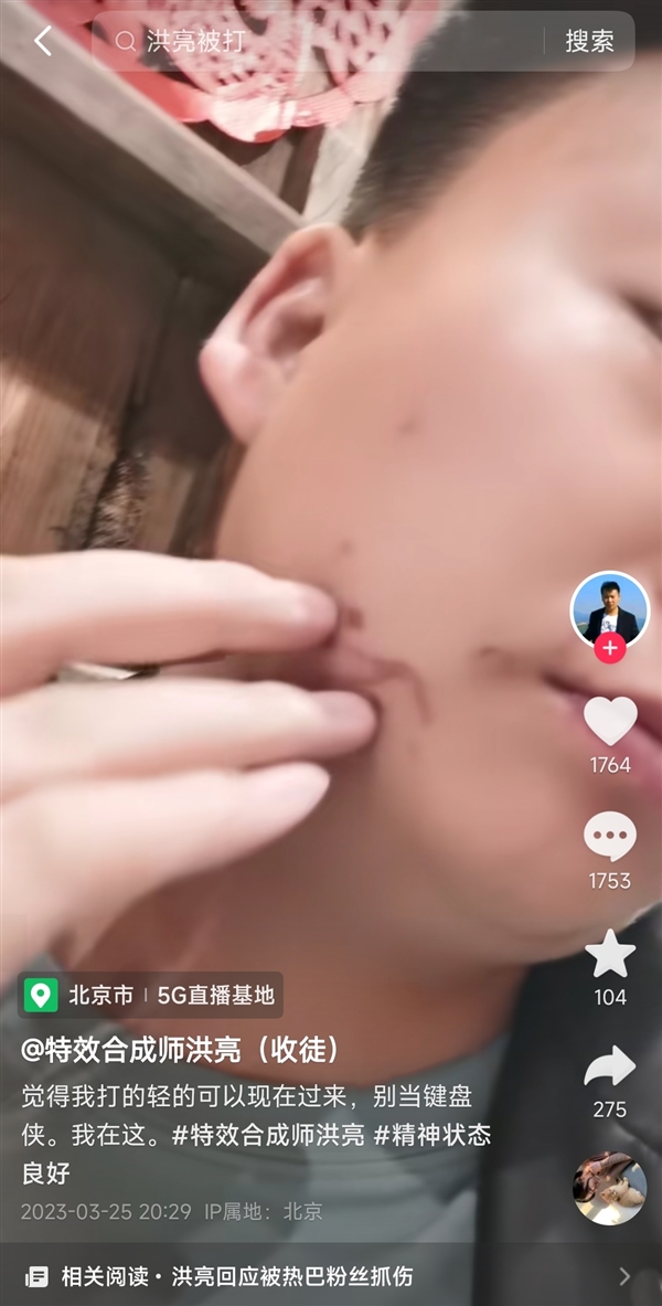 男网红称因合成与女星接吻视频被打破相:律师称涉侵犯肖像权