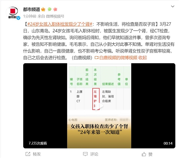 24岁女孩入职体检发现少了个肾:24年来第一次知道