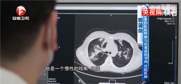 女子接触发霉玉米肺里长黄曲霉菌 没戴口罩防护：医生科普毒性超强