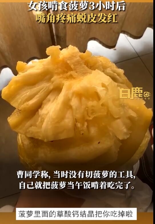 女孩拿菠萝当午饭啃食后烂嘴:3小时后嘴角全烂