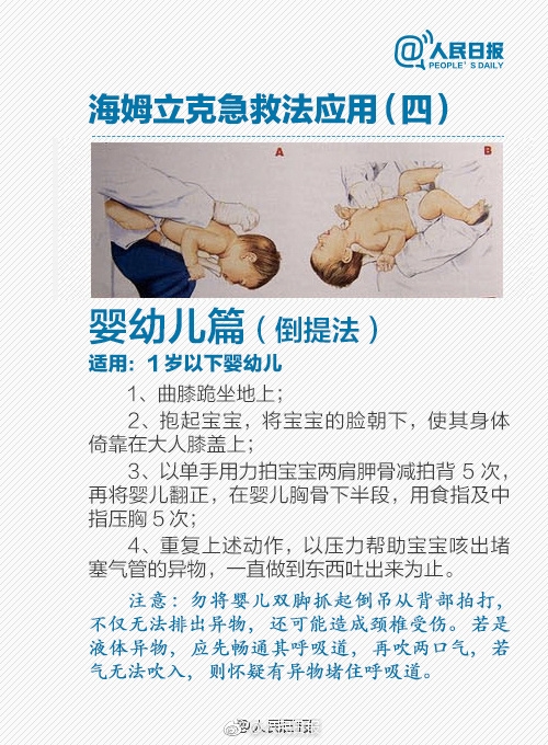救命方法码住!爸爸吃饼卡喉:15岁女儿1分钟救回