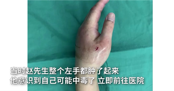 男子被宠物魔鬼鱼刺伤险丧命 专家:鲨鱼同类 含神经毒素