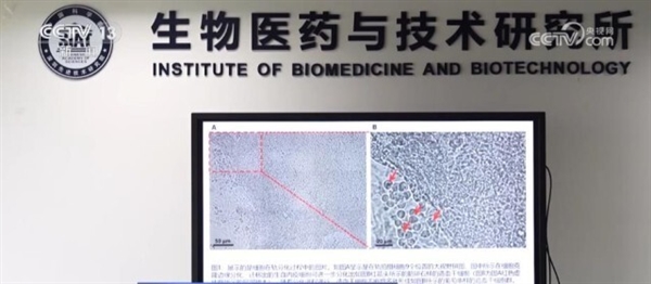 重大突破!我国首次实现人类干细胞太空造血
