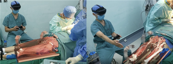 全国首例！“元宇宙”可视化皮瓣移植术成功实施：医生像开了透视眼