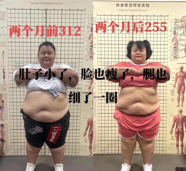 312斤女网红在减肥营离世：2个月内暴瘦57斤