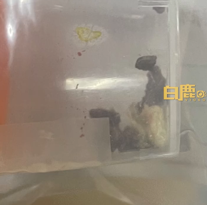 女生称因为爱抠鼻子 导致鼻内长了10多团真菌：胆小勿入
