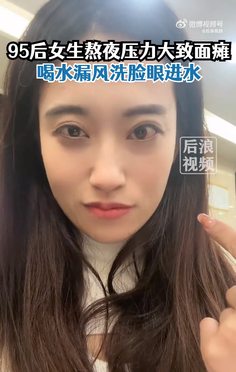 95后女生长期熬夜焦虑起床面瘫:嘴歪眼斜 医生建议年轻人适当放松
