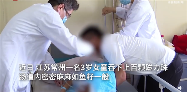 女童吞下上百颗磁力珠肠道如鱼籽：画面让网友发麻 家长太粗心