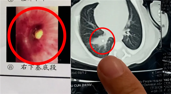 家长信偏方致3天大宝宝气管堵塞 网友吐槽:很多老人愚昧还自以为是