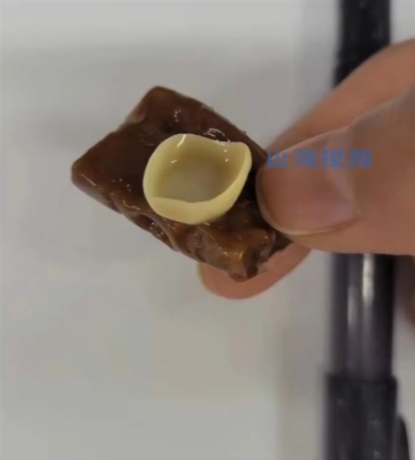 原来糖粘牙是真的!00后女生上班吃糖粘掉假牙