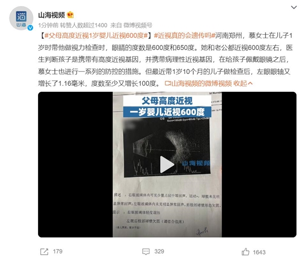 父母高度近视:1岁婴儿近视600度