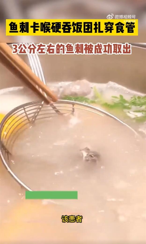 男子被鱼刺卡喉硬吞饭团：结果扎穿食管