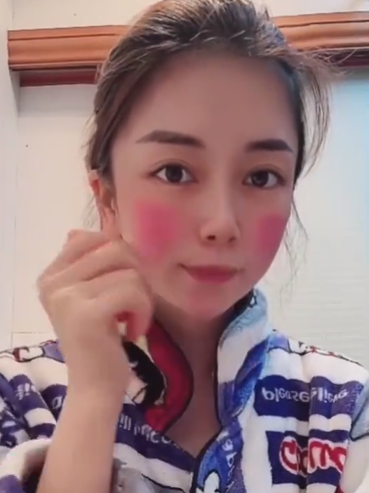 女子高烧39度 脸颊烧红如两大块斑：网友科普 千万别大意