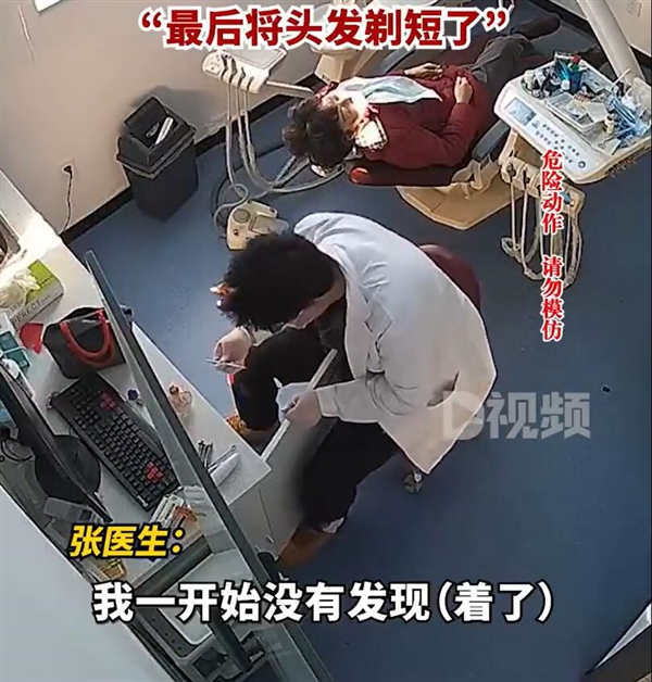 医生低头取物头发被酒精灯点燃 当事人：第一眼不敢相信