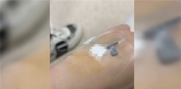 喝了预开口椰子进急诊?哪些人不能喝椰子水