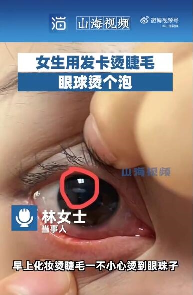 化妆注意安全！女生用发卡烫睫毛眼球烫个泡