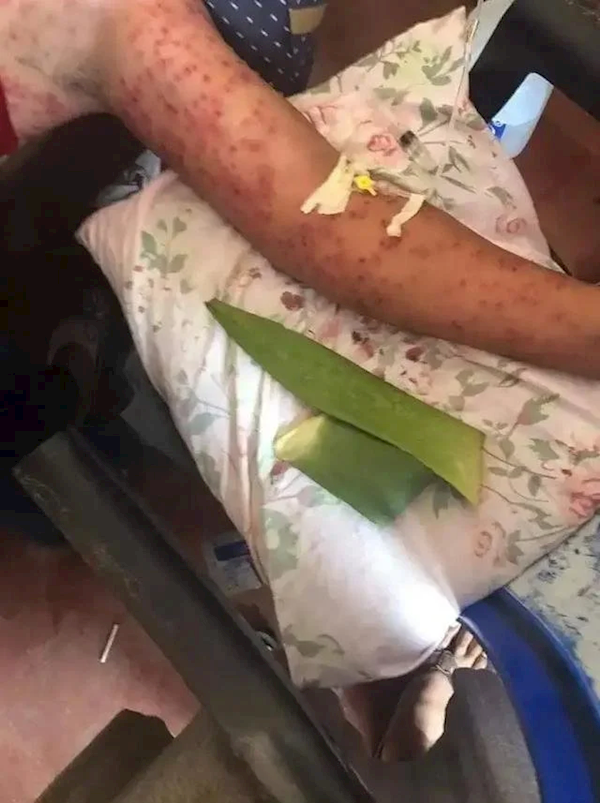 公交车坠入峡谷 6人被杀人蜂蜇死 浑身数百处“针眼”