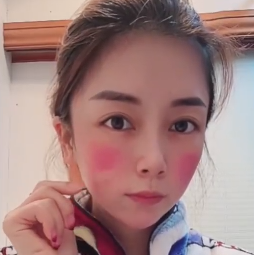 女子高烧39度 脸颊烧红如两大块斑：网友科普 千万别大意