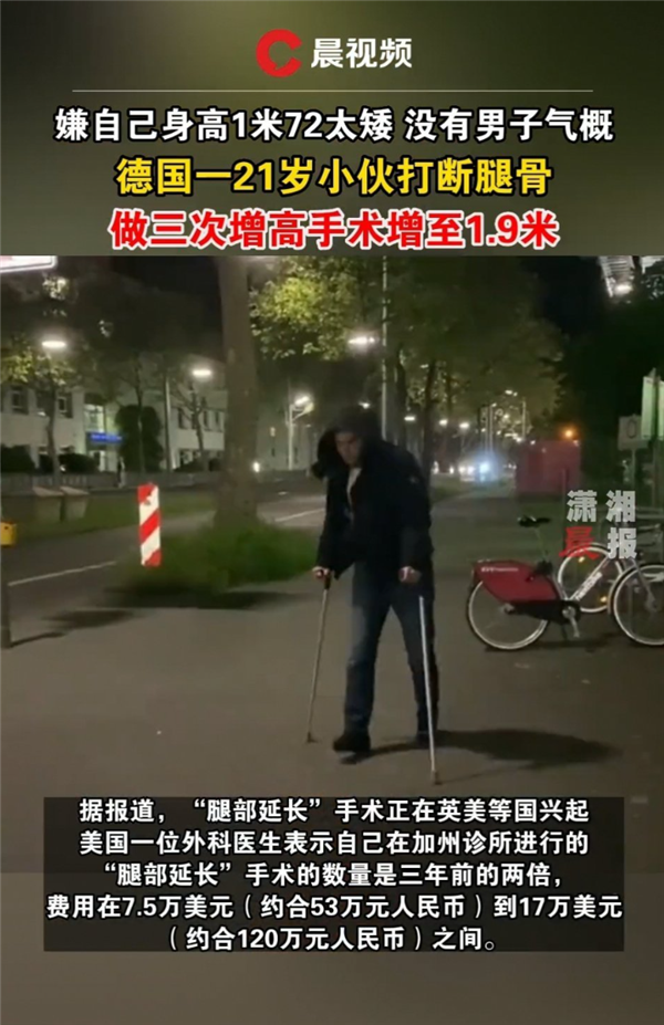 小伙打断腿骨做三次增高手术 从1米7增至1米9:不做就像侏儒 不后悔