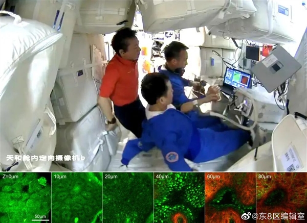 中国空间站双光子显微镜测试成功：首获航天员皮肤三维图像