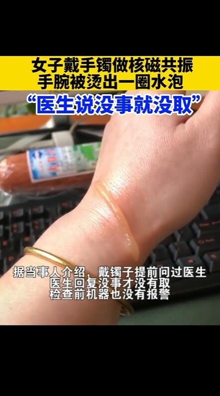 女子戴金手镯做核磁共振:手腕被烫出一圈水泡