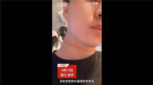 可怕一幕!男子骑摩托车遭风筝线勒喉受伤 官方科普风筝线比刀还锋利